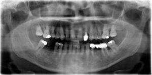 Intervention dentaire1